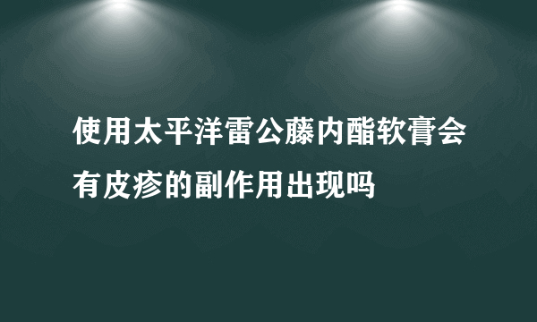 使用太平洋雷公藤内酯软膏会有皮疹的副作用出现吗