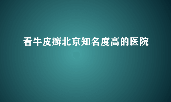 看牛皮癣北京知名度高的医院