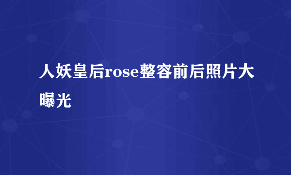 人妖皇后rose整容前后照片大曝光