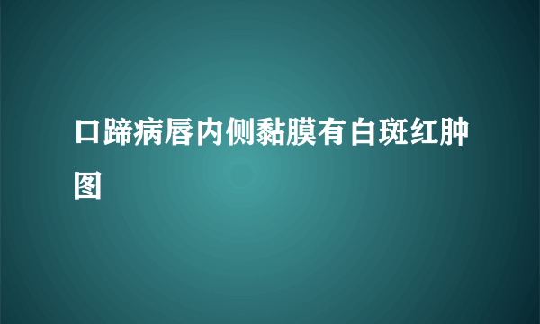 口蹄病唇内侧黏膜有白斑红肿图