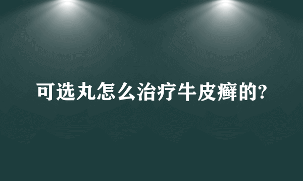 可选丸怎么治疗牛皮癣的?