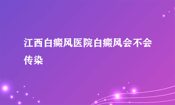 江西白癜风医院白癜风会不会传染