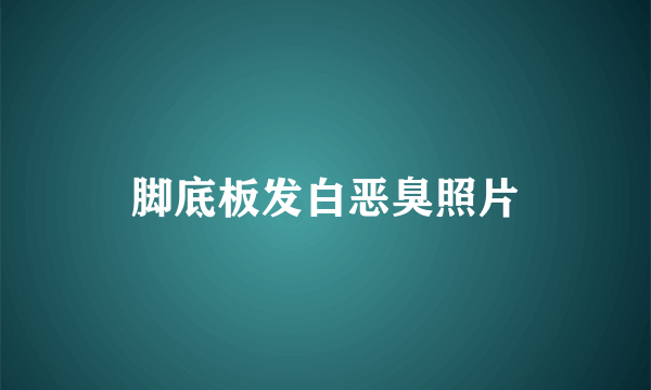 脚底板发白恶臭照片