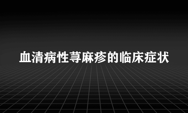 血清病性荨麻疹的临床症状