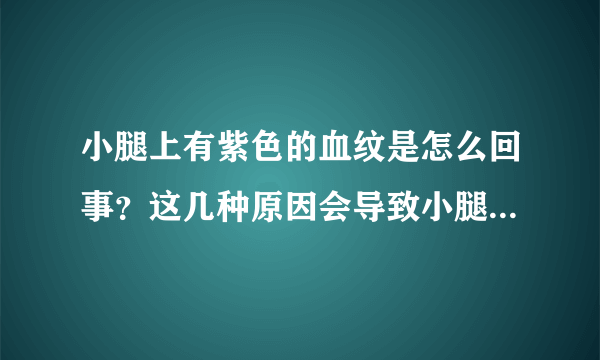 小腿上有紫色的血纹是怎么回事？这几种原因会导致小腿上有紫色的血纹