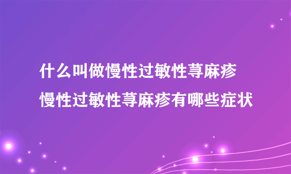 什么叫做慢性过敏性荨麻疹 慢性过敏性荨麻疹有哪些症状