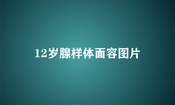 12岁腺样体面容图片