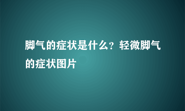 脚气的症状是什么？轻微脚气的症状图片