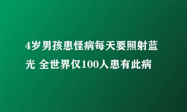 4岁男孩患怪病每天要照射蓝光 全世界仅100人患有此病