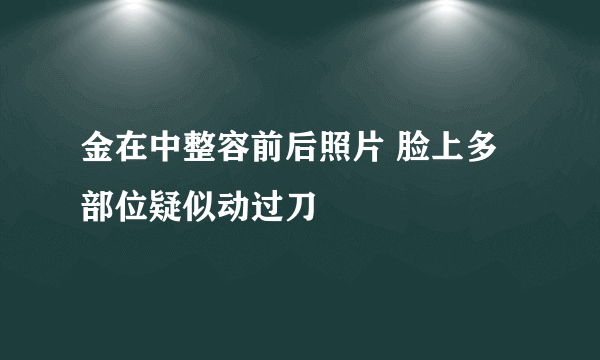 金在中整容前后照片 脸上多部位疑似动过刀