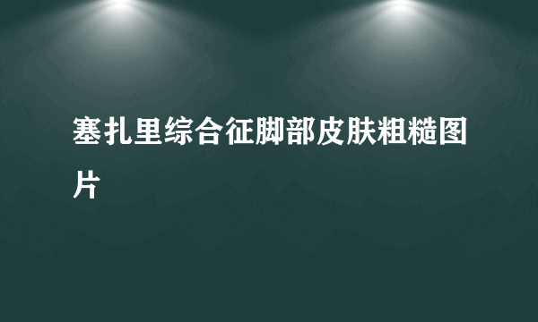 塞扎里综合征脚部皮肤粗糙图片