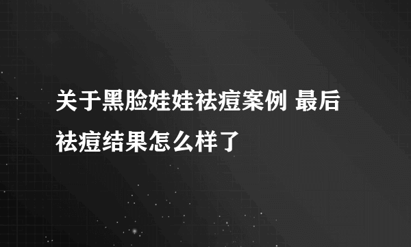 关于黑脸娃娃祛痘案例 最后祛痘结果怎么样了