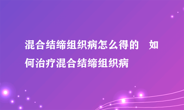 混合结缔组织病怎么得的   如何治疗混合结缔组织病