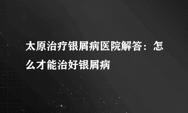 太原治疗银屑病医院解答：怎么才能治好银屑病