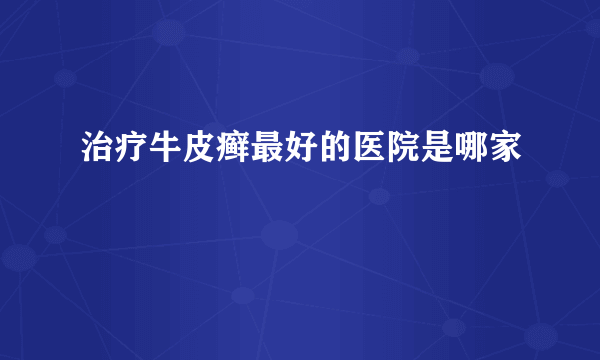 治疗牛皮癣最好的医院是哪家