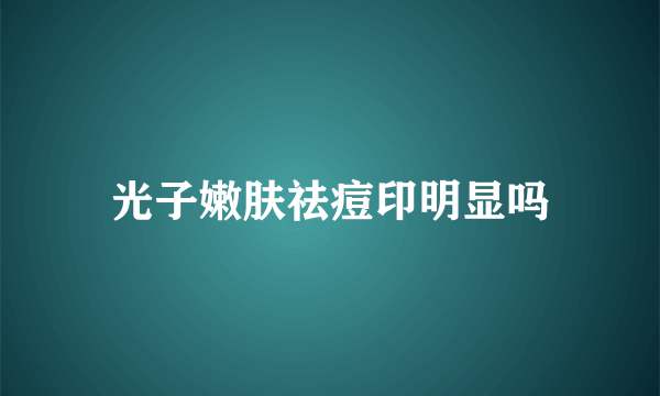 光子嫩肤祛痘印明显吗